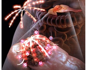 초소형 LED 장치로 췌장을 감싸 암세포 제거한다